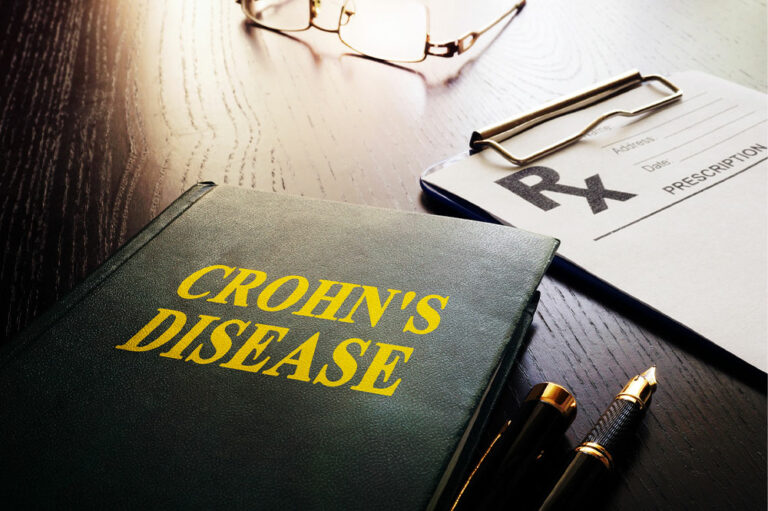 Top 10 early warning signs of Crohn’s