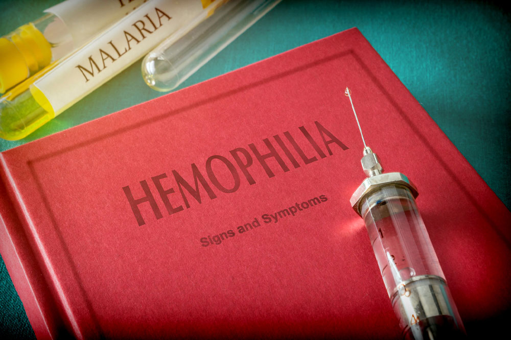 Hemophilia – Symptoms to look out for