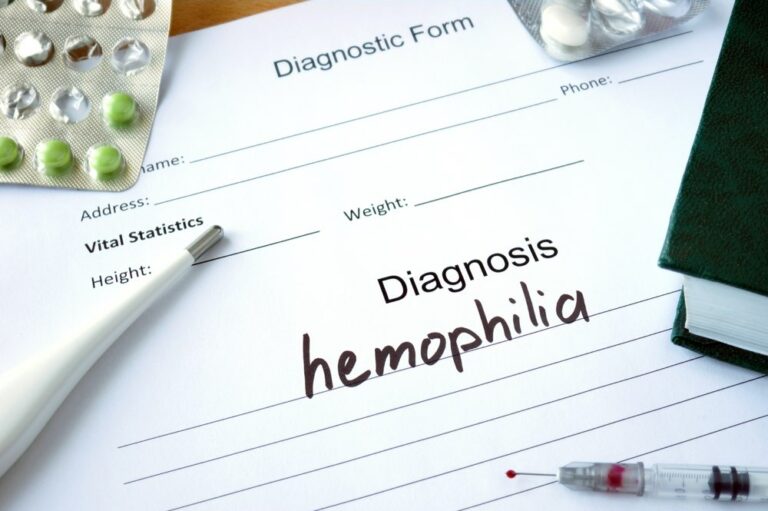 Here’s what to eat for hemophilia